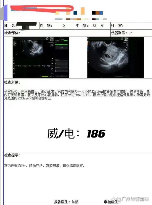 北京正规捐卵机构服务介绍